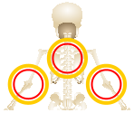 Skeleton - Hole In The Wall: Twisted Figures