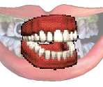 Chatterteeth - Gingiva